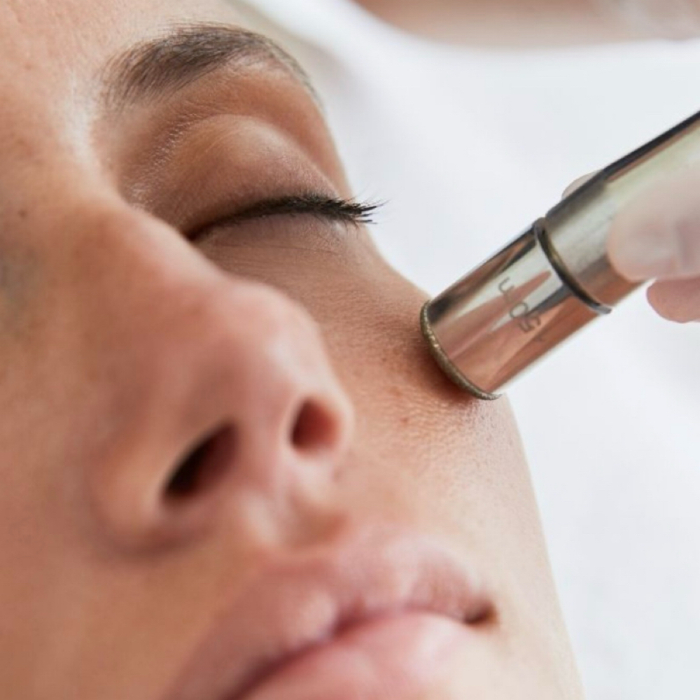 Microderm Facial at Flawless By Figgz in Queen Creek, AZ