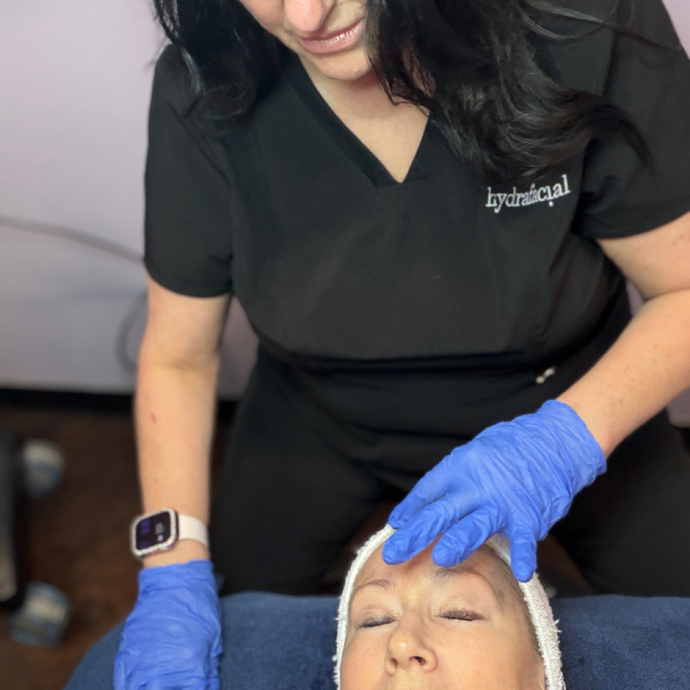 Customized Smart Peel at Glam by Tam Aesthetics in Madison, WI