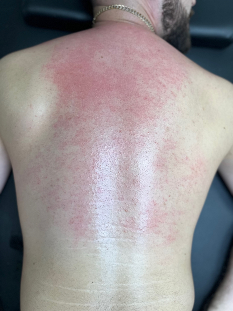 Back Wax