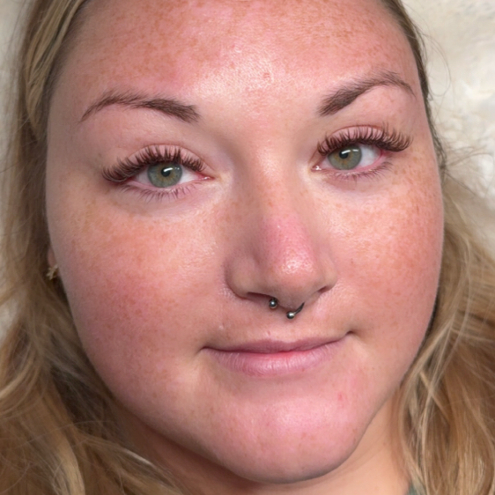 Quick Fill | 7–10 Days at Elevate by Arline Transformational Skin & Effortless Beauty in Cedar Park, TX