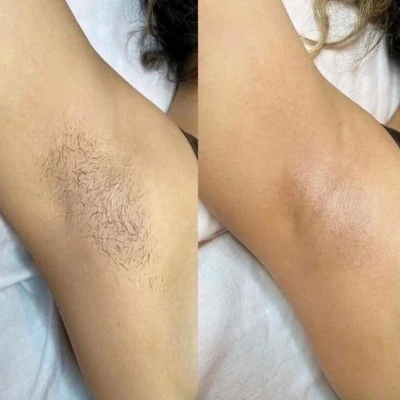 Underarm Wax at Sacred Beauty in Las Cruces, NM