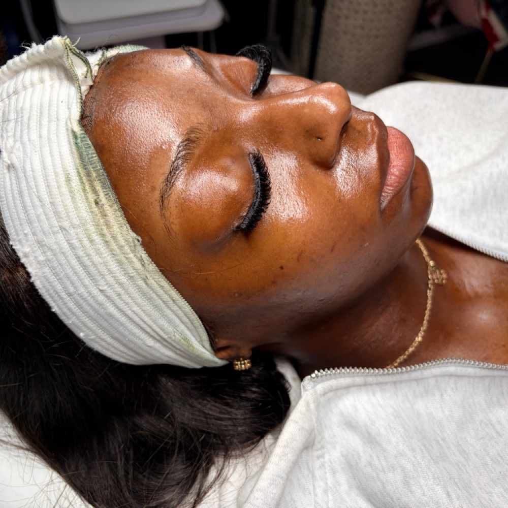 Be Mine package at Sken Fetysh Aesthetics in Arlington, TX