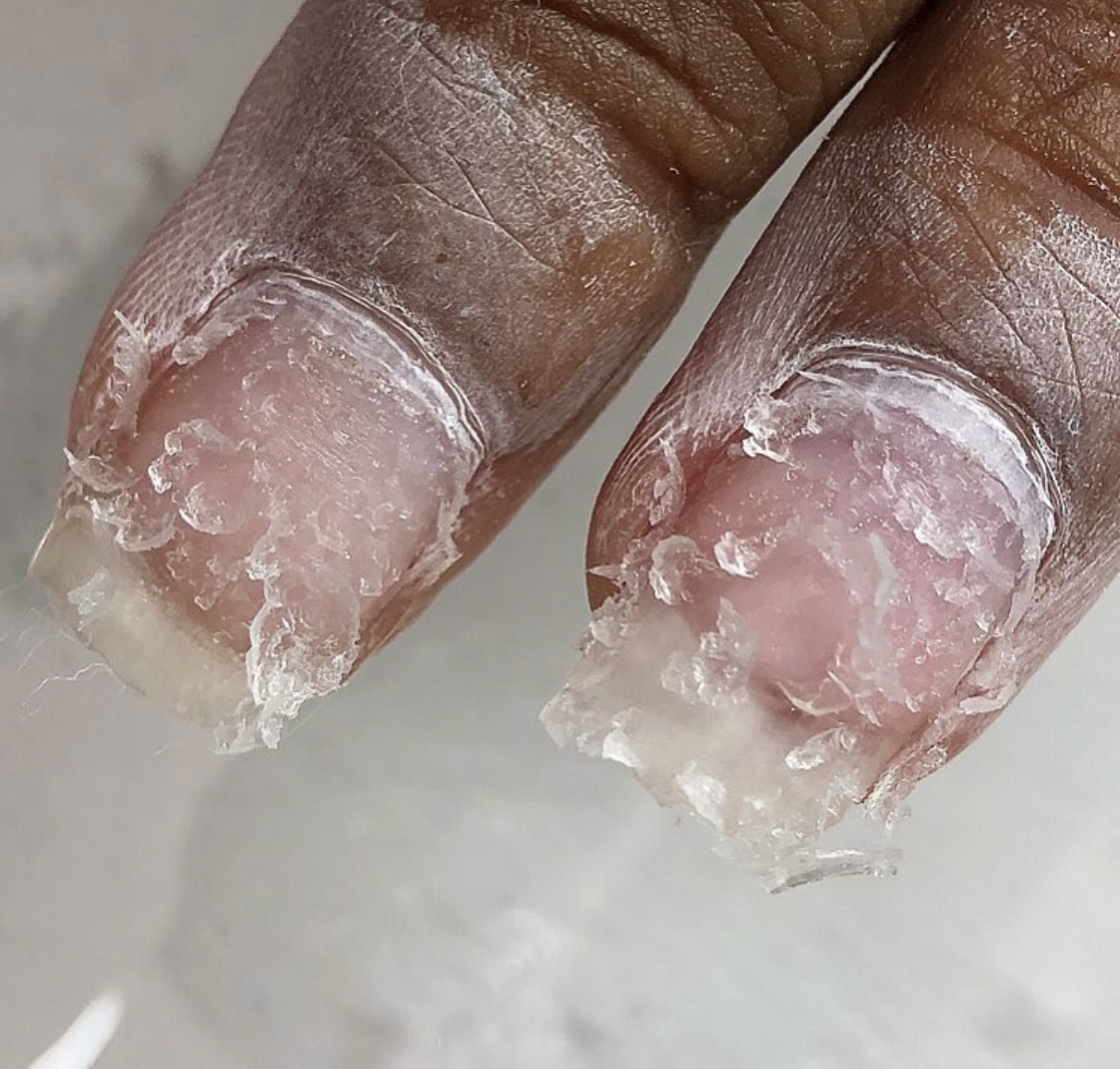 Gel-X Full Removal