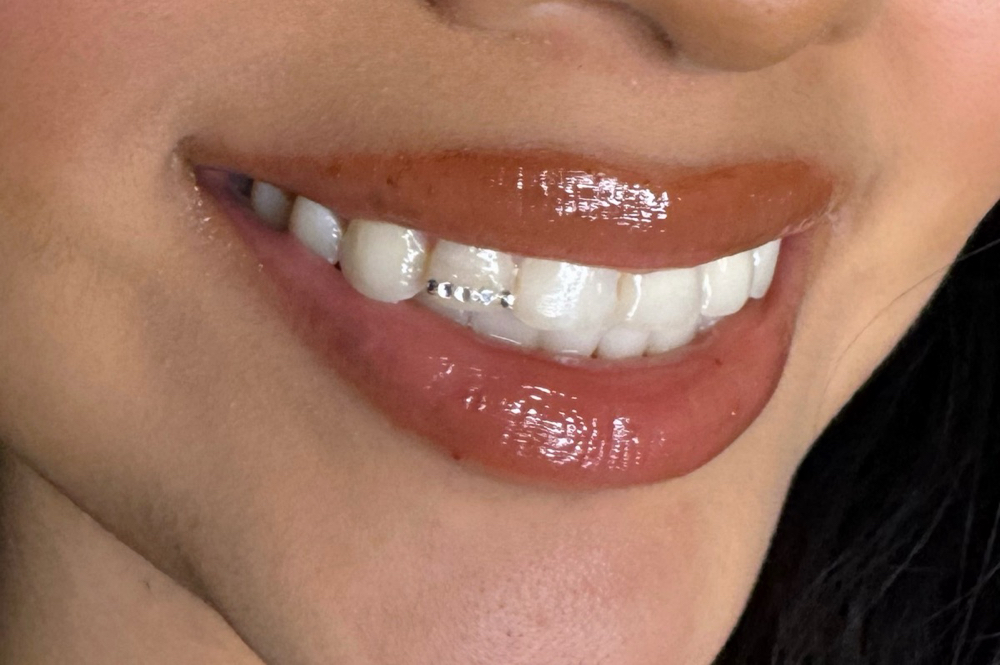 Edge Tooth Gems
