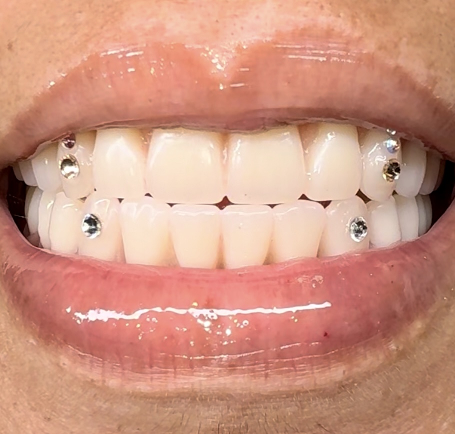Round Swarovski Crystal Tooth Gems