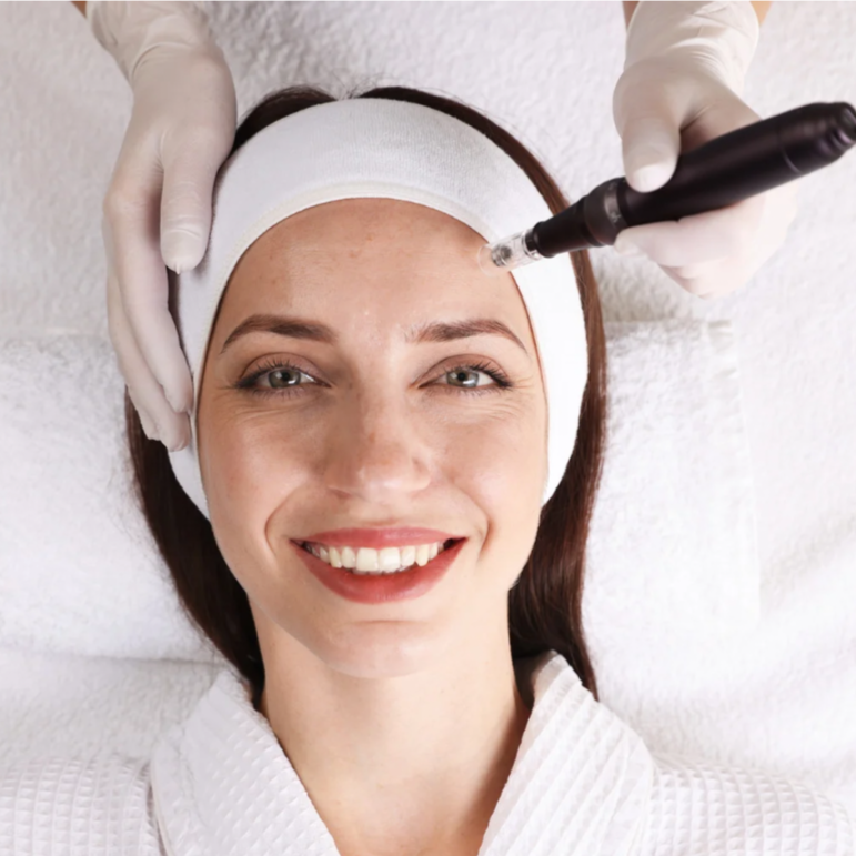 Microneedling With PRP at Luna Aesthetics in Alexandria, VA