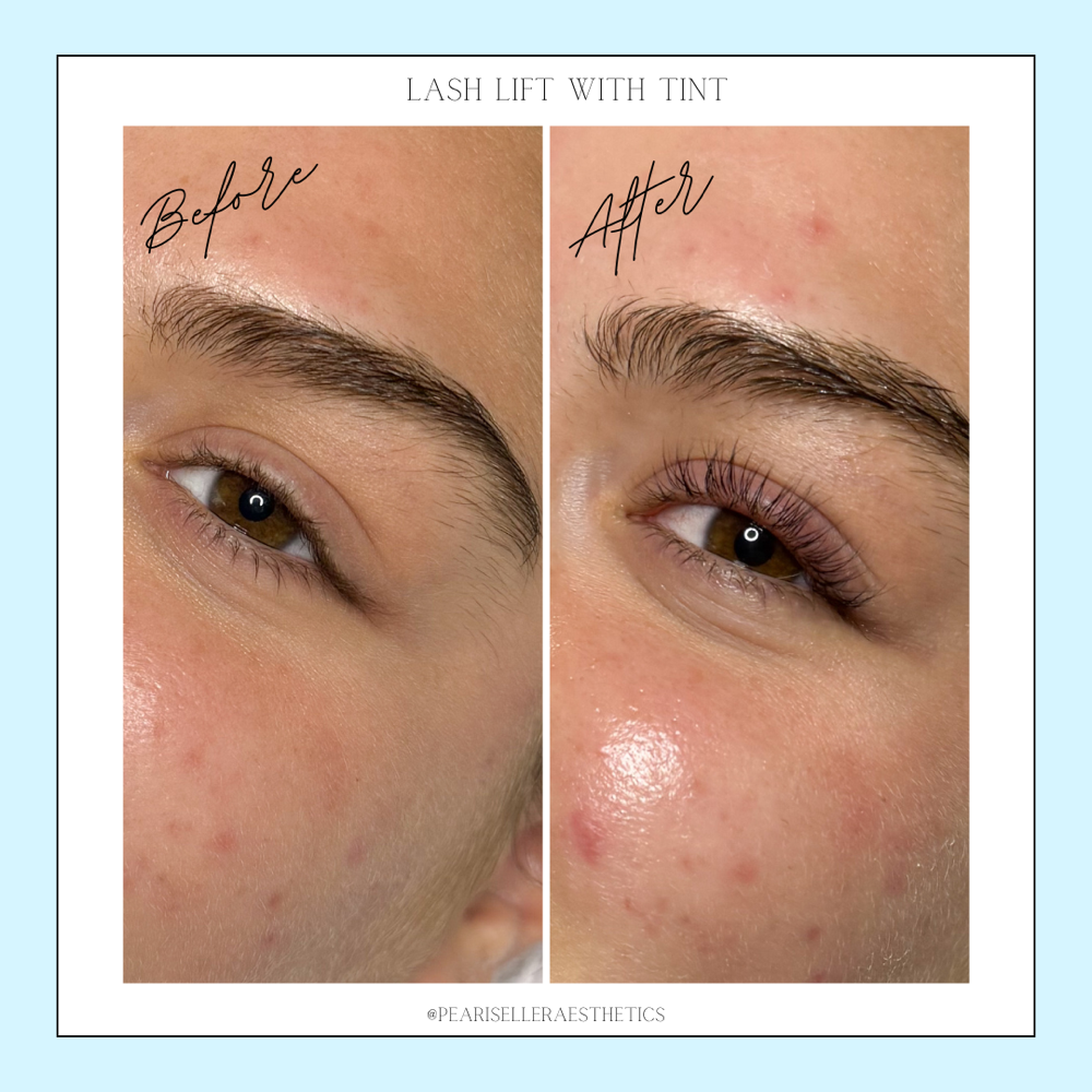 Lash Lift