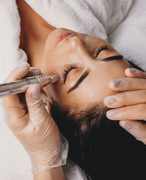 Microdermabrasion