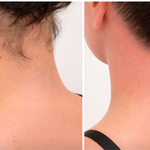 Waxing Nape of Neck (By Hairline) at Blush Beauty Boutique in Easton, PA