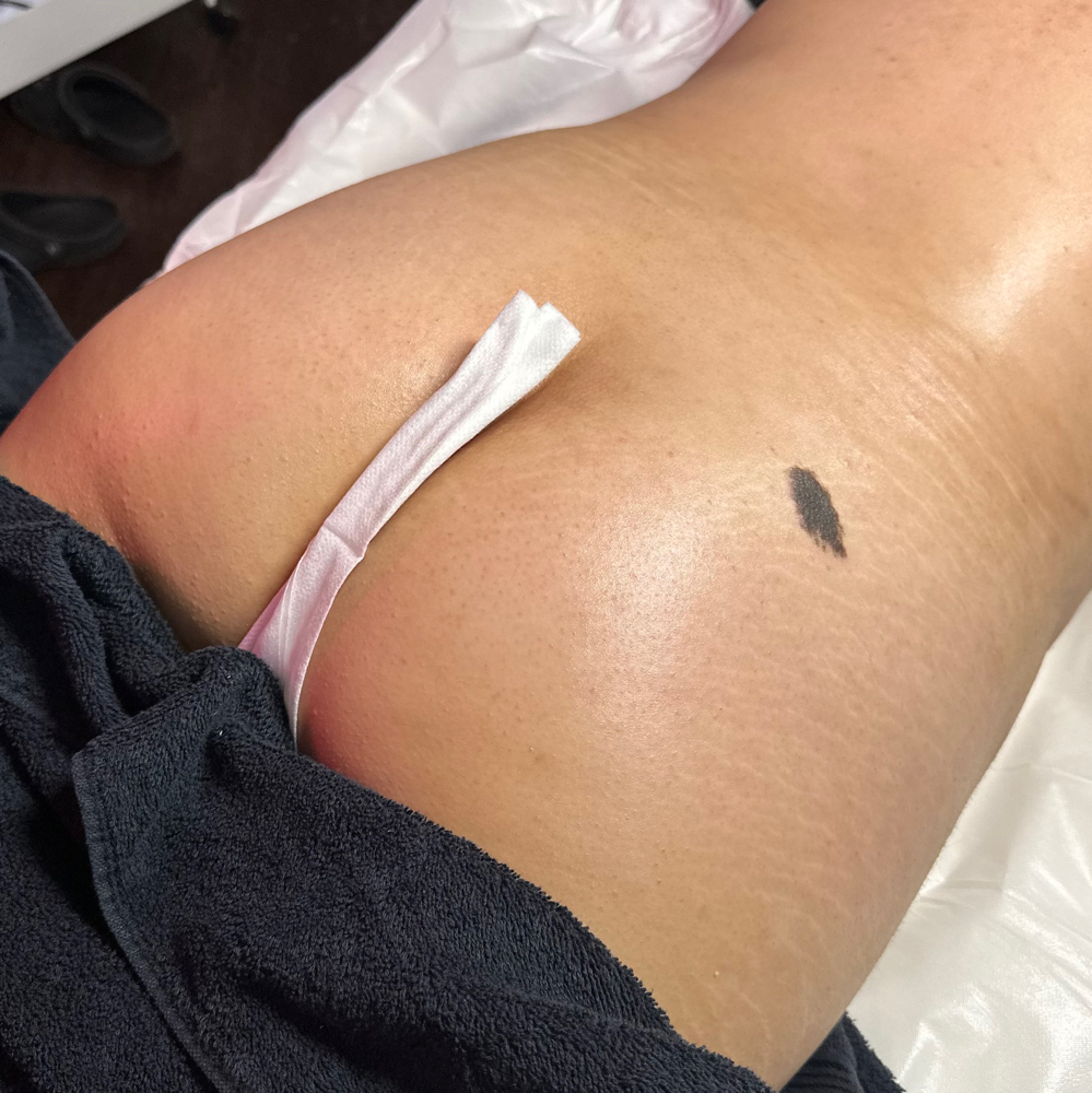 Cheeky Brazilian Wax