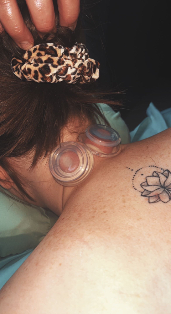 ADD-ON Cupping Therapy