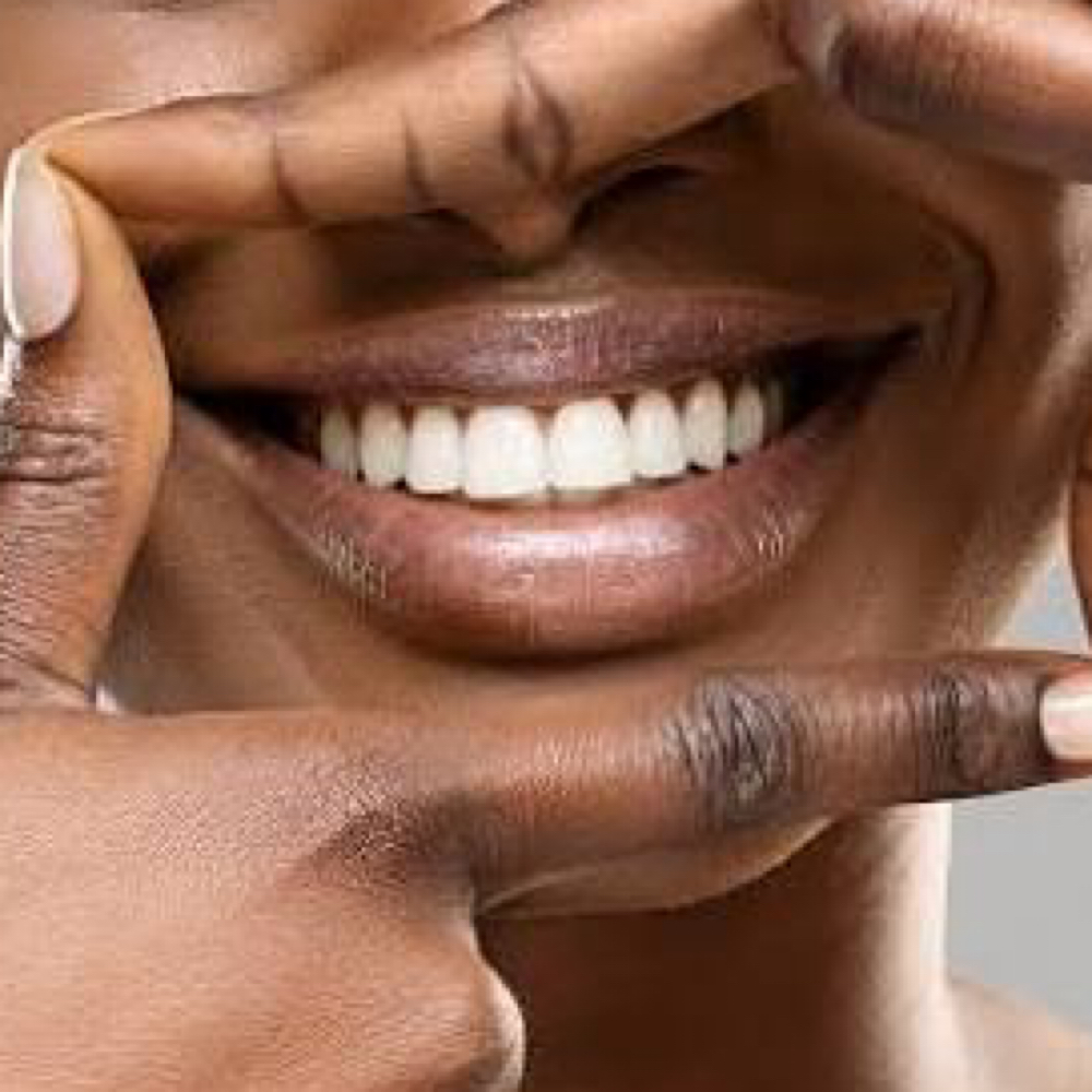 Signature Whitening at Enthused Smiles in Montclair, NJ