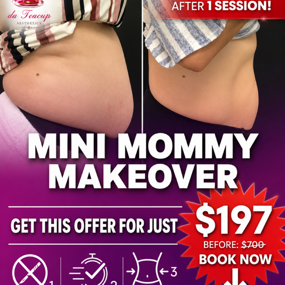 ✨ Body Sculpting – Single Area Sess at The Teacup Body Sculpt & Glow in Hillside, IL