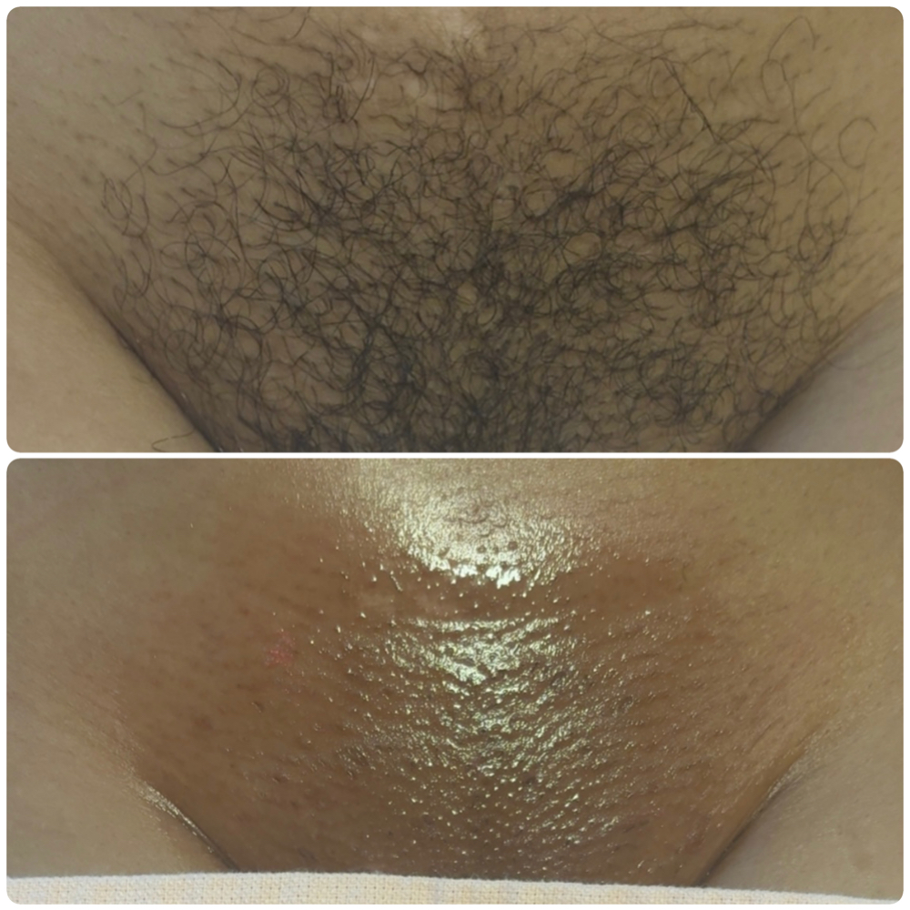 Brazilian YEARLY Subscription at Beauty By KB in Pittsfield, MA