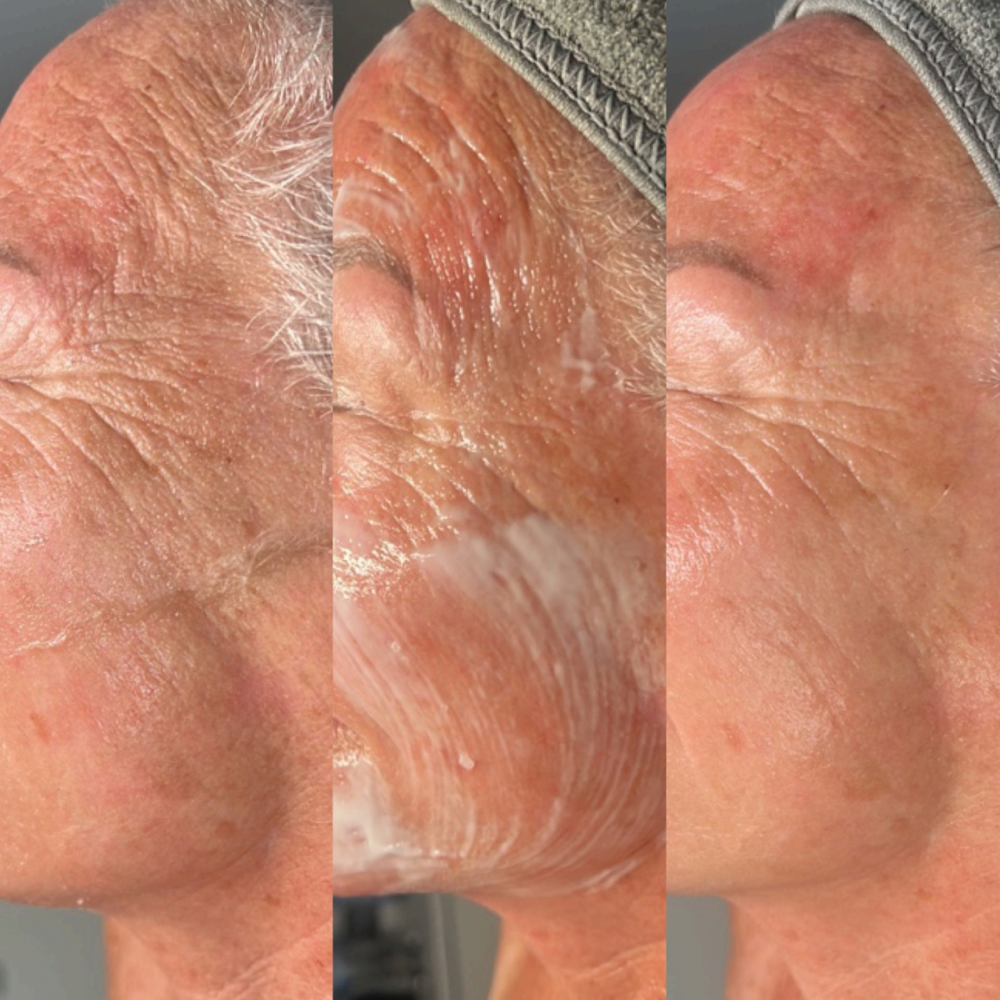 New Client Facial