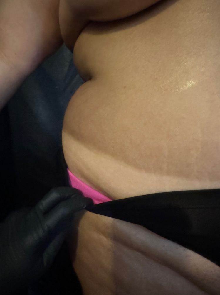 Rapid Tan