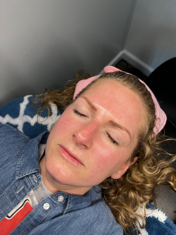 Dermaplane Facial