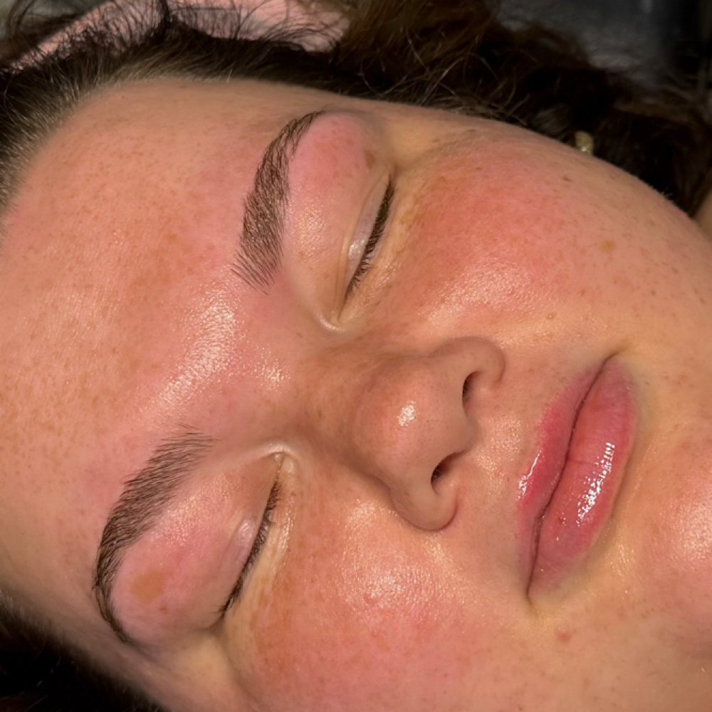 Dermaplane Facial at Worthy of Beauty By Gracee in Lima, OH