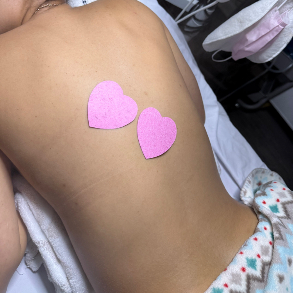 Back Facial at Mjzlamouresthetic in Brandon, FL