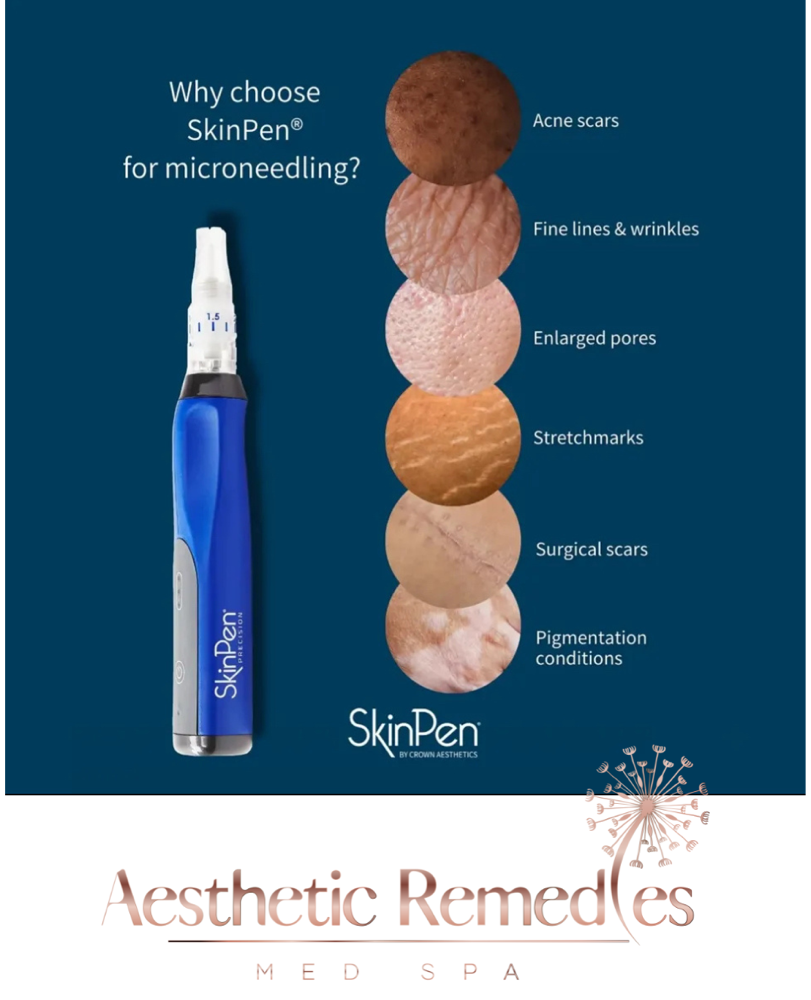 Micro-needling with PRP (single tx)