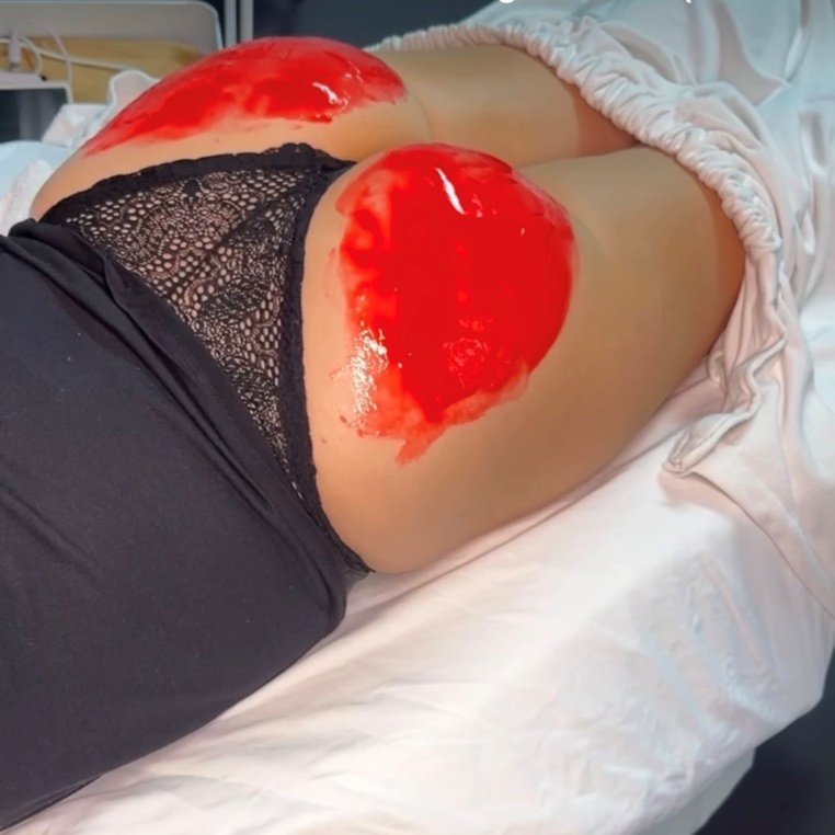 Booty Facial at Santana Skin Studio in El Paso, TX