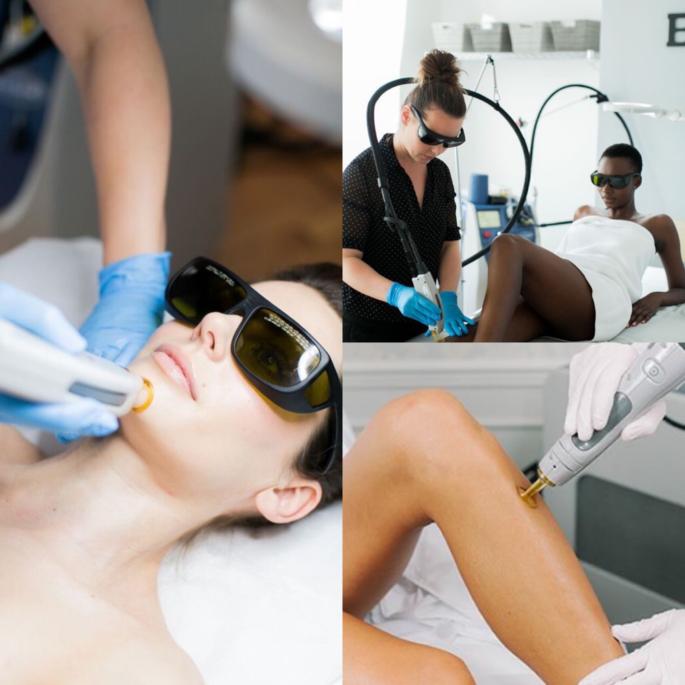 Laser Hair Removal - Underarms