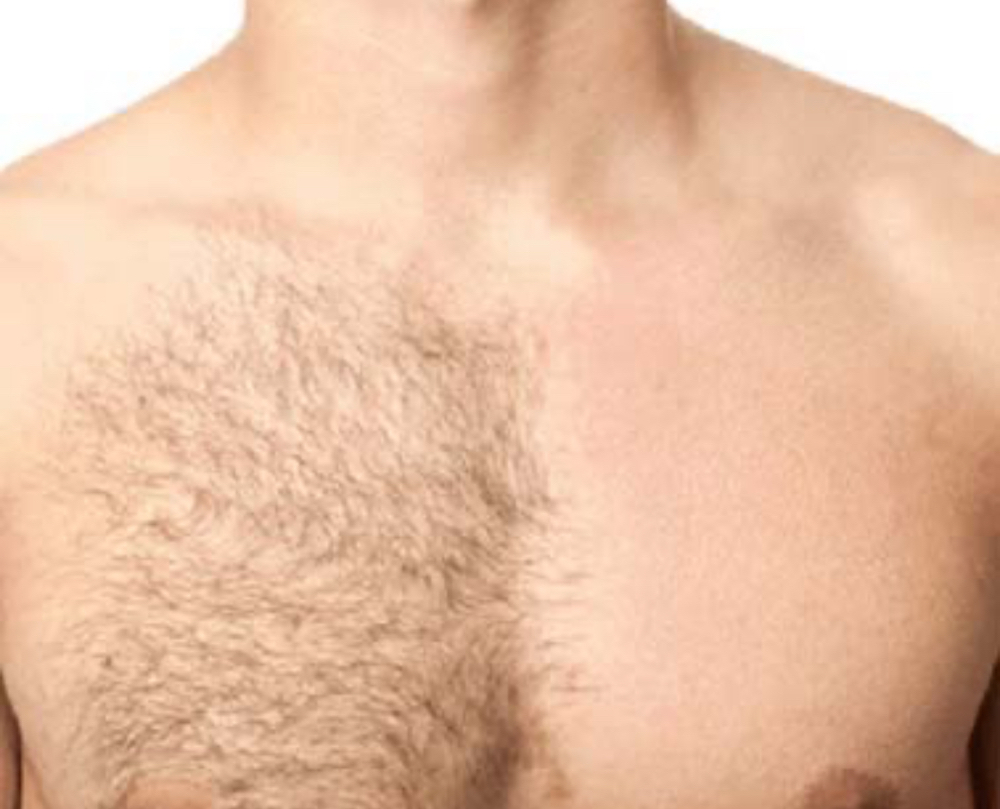 Chest Wax