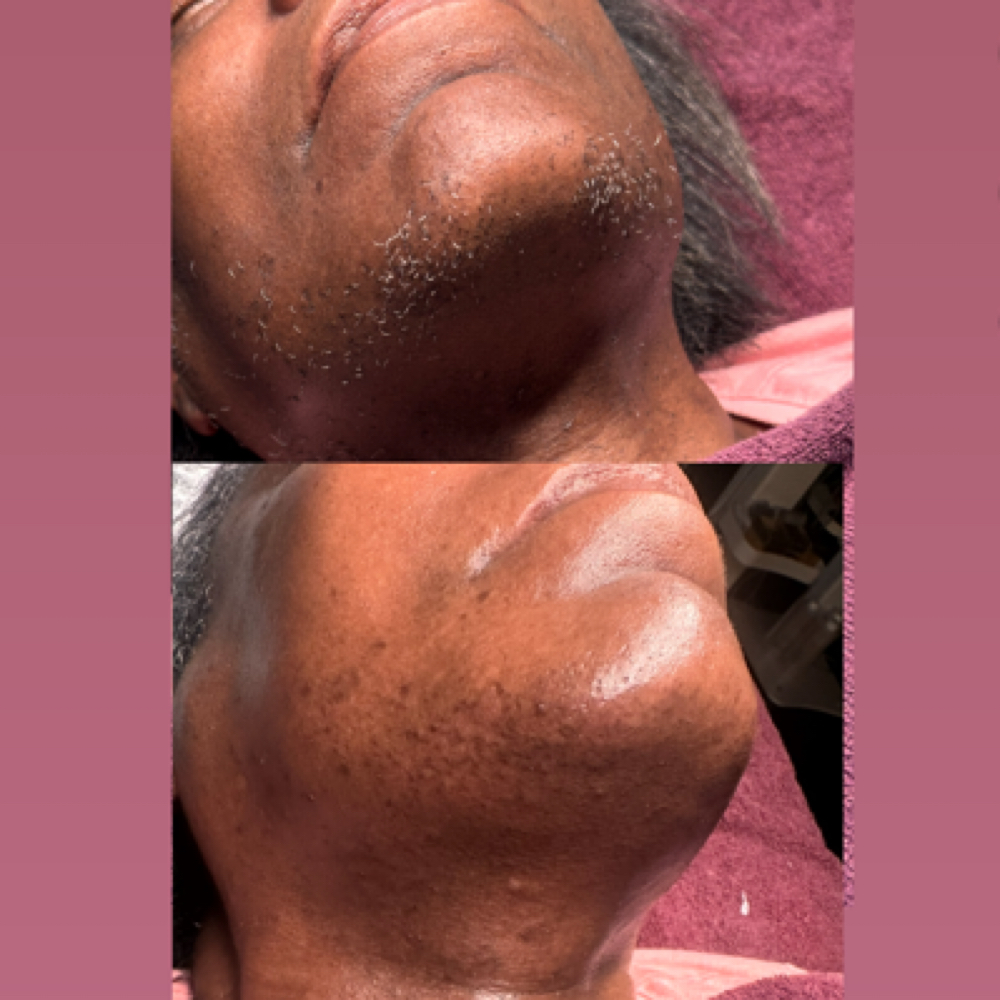 Full Face Wax at She Esthetics LLC in Columbus, GA