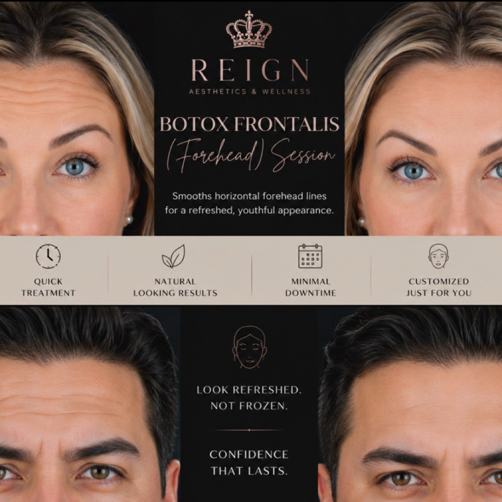 Botox Frontalis (Forehead) at Peridot Studio in Lubbock, TX