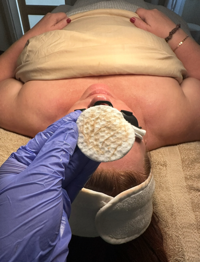 Dermaplane Session