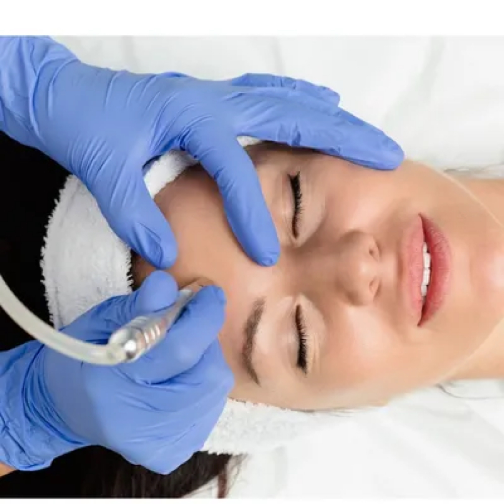 Microdermabrasion