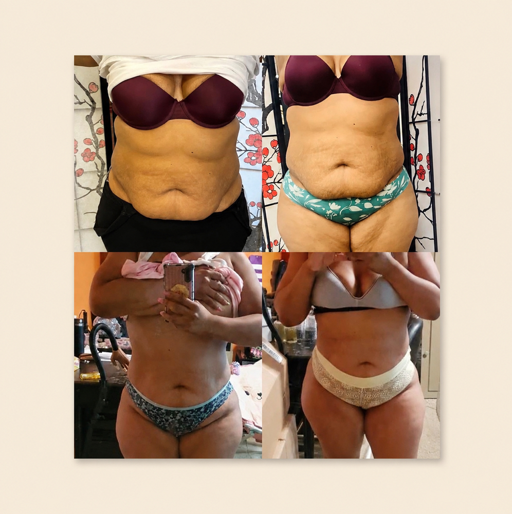 Waist Sculpt - 12 Session Package at BODIEDBYNICKEI LLC in The Bronx, NY