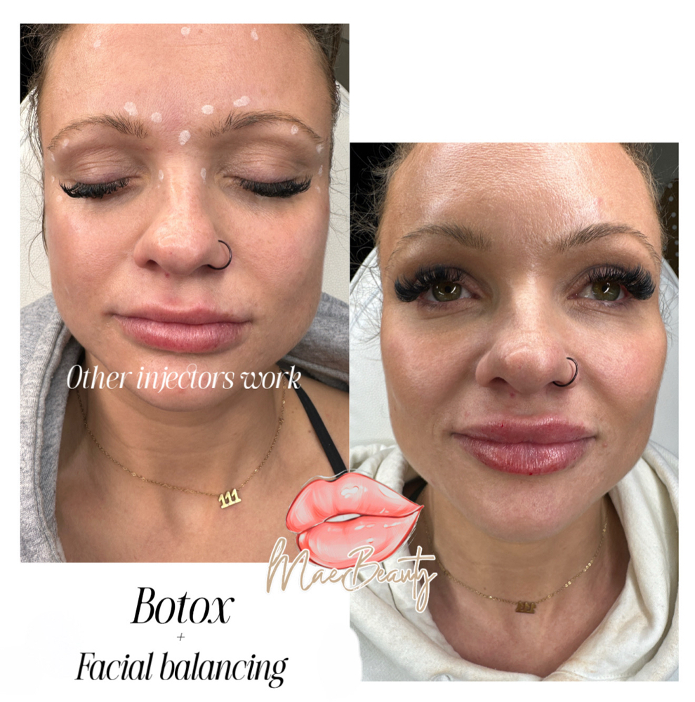 Facial Balancing Specials at MaeBeauty in Mesquite, TX