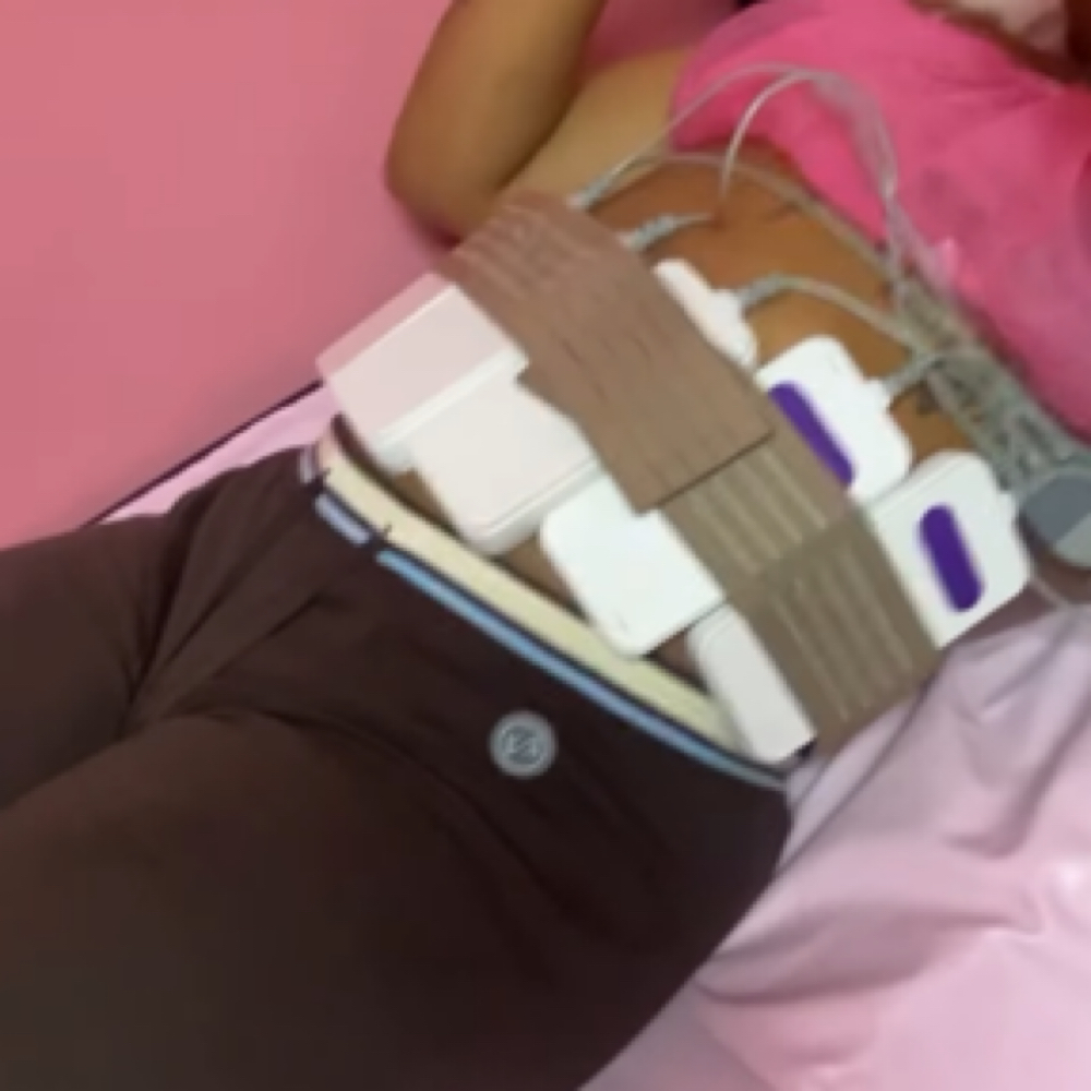 Tummy Control 180 Sess at Finesse Sculpt Body Studio in Parkville, MD