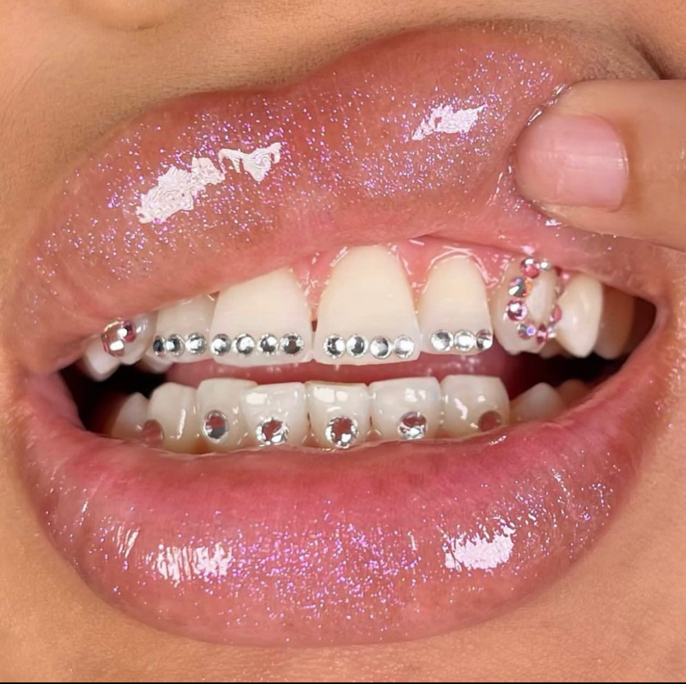 Tooth gems