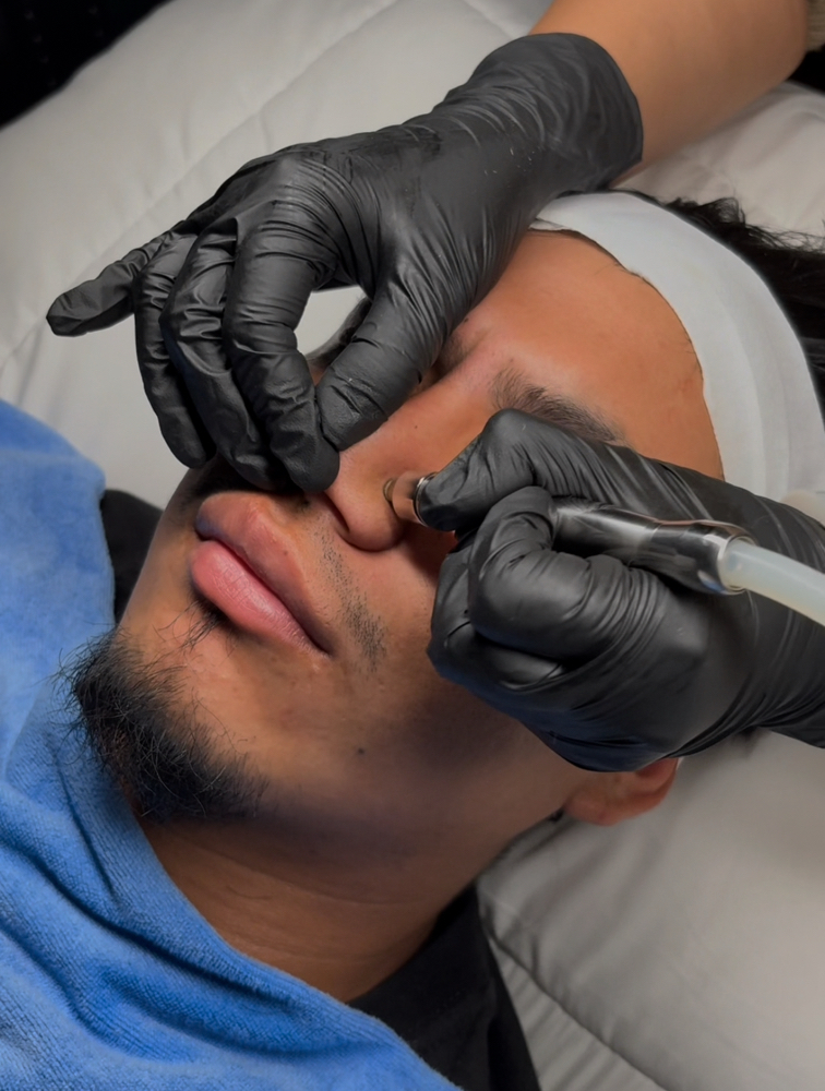 Tier 2 Facial