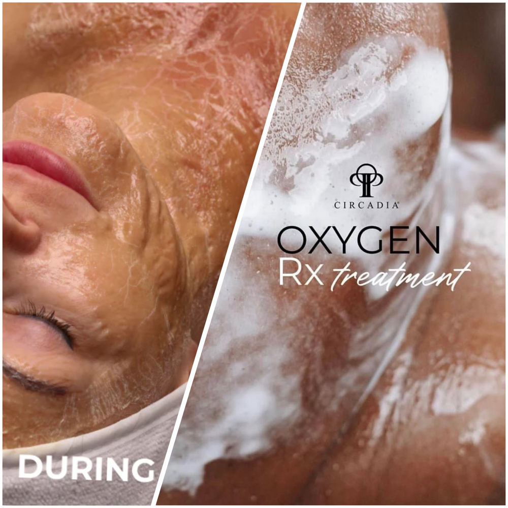 DELUXE Facial at SKN Co. Esthetics in Brewster, NY