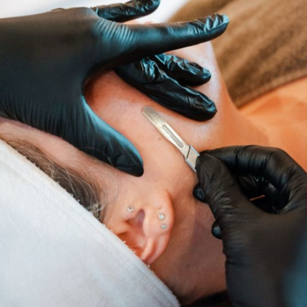 ADD-ON: Dermaplaining at A esthetics & Wellness in Joliet, IL