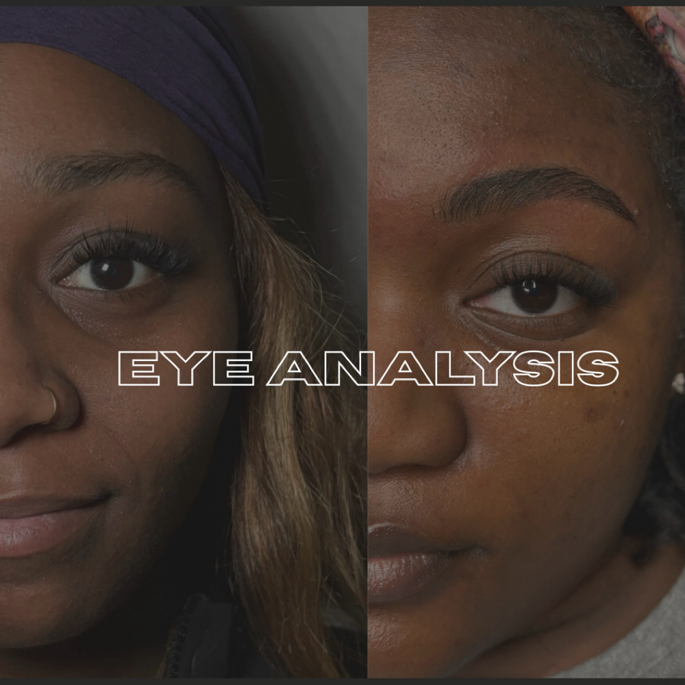 Custom Eye Analysis Consultation at Mo Skin Beauty in Tampa, FL