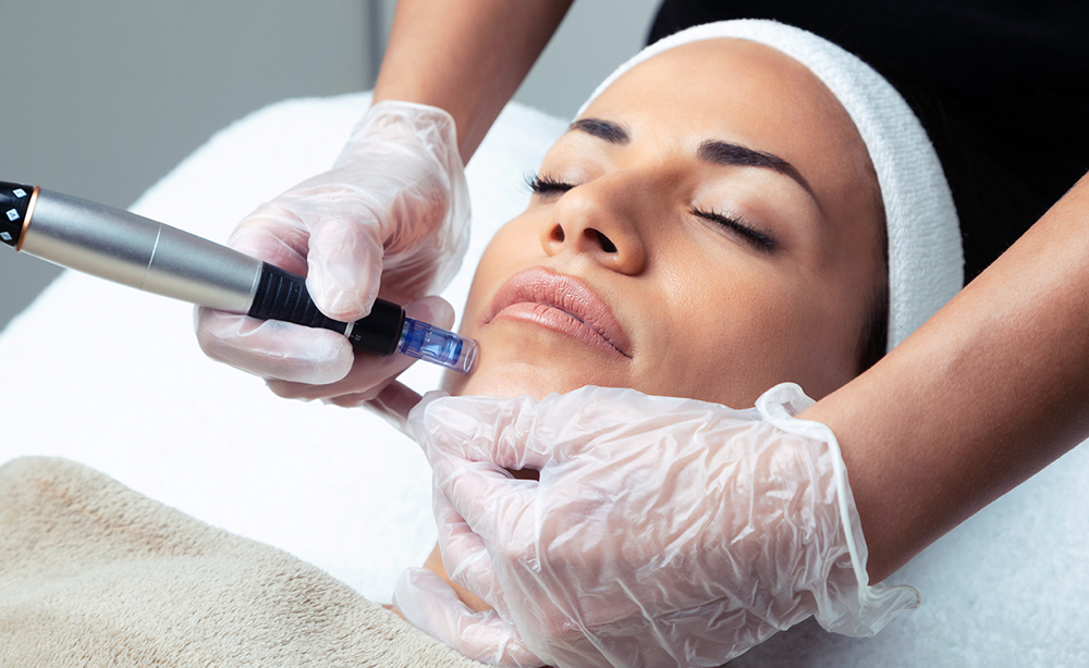 Microneedling (Collagen Induction)