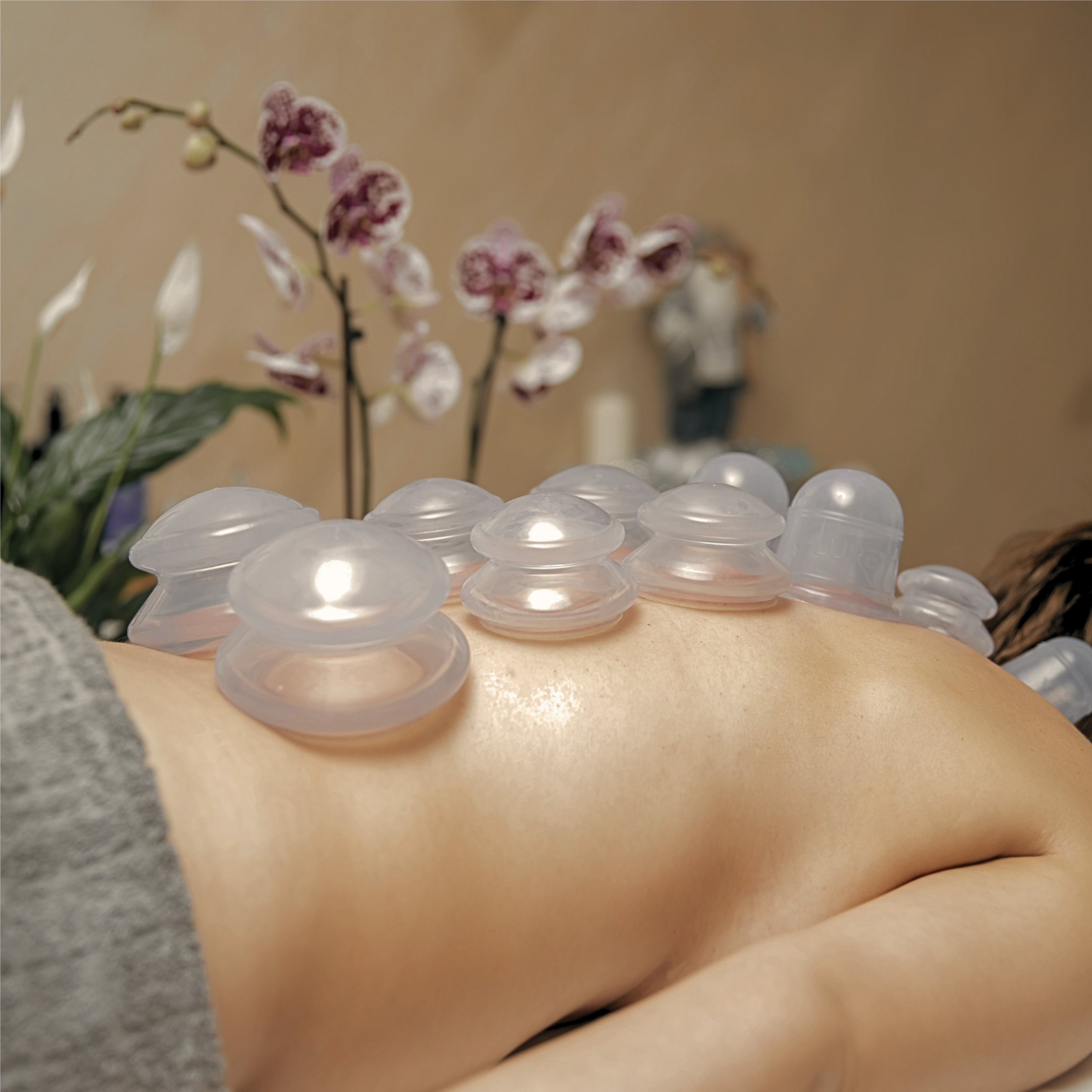 Cupping Therapy at Anointed Rest Massage in Spokane, WA