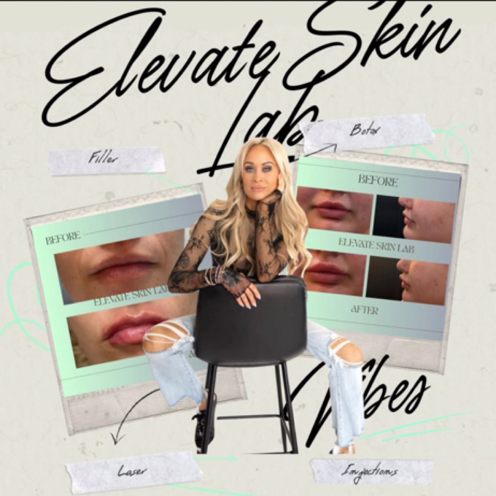 Consultation- In Person at Elevate Skin Lab in Desloge, MO