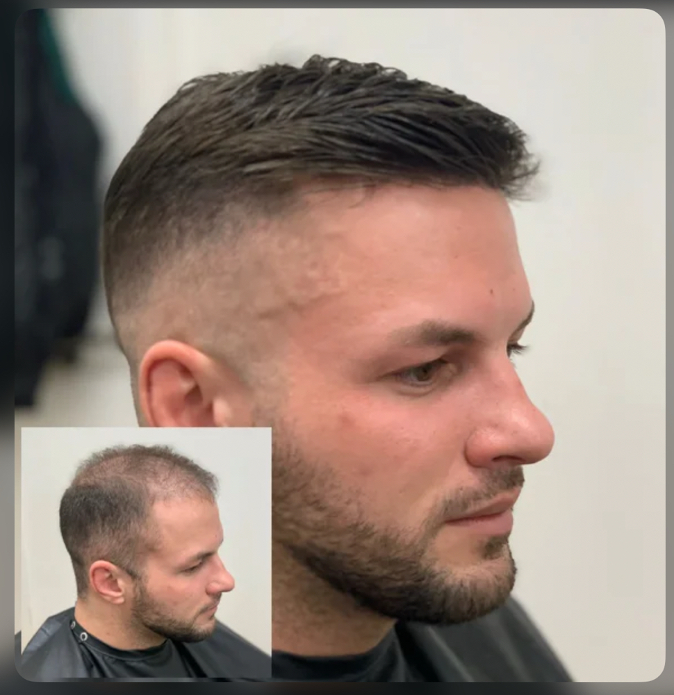 The Rebirth (First Time Install)