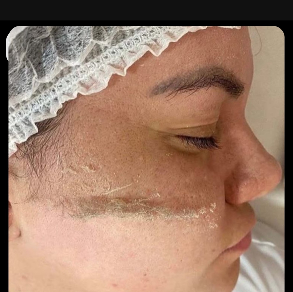 Manual Exfoliation Stand Alone