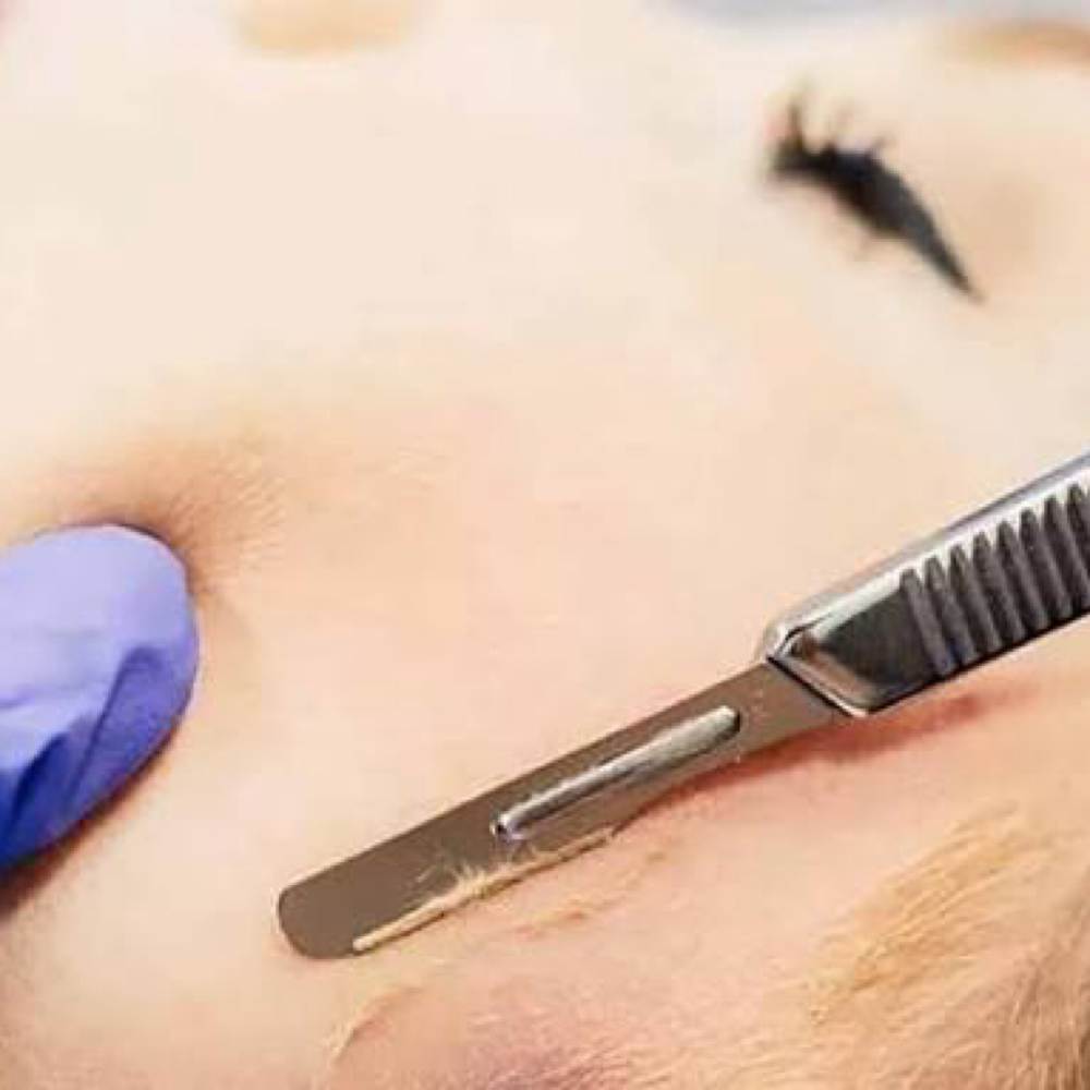 Dermaplaning Facia at Haus of Beauty Studio in Hialeah, FL