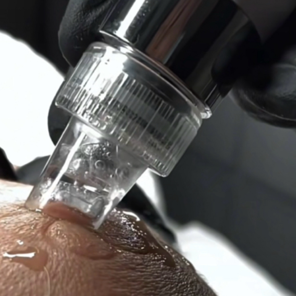 Hydro Detox Deep Clean Facial at Skincare By Liliya in Sherman Oaks, CA