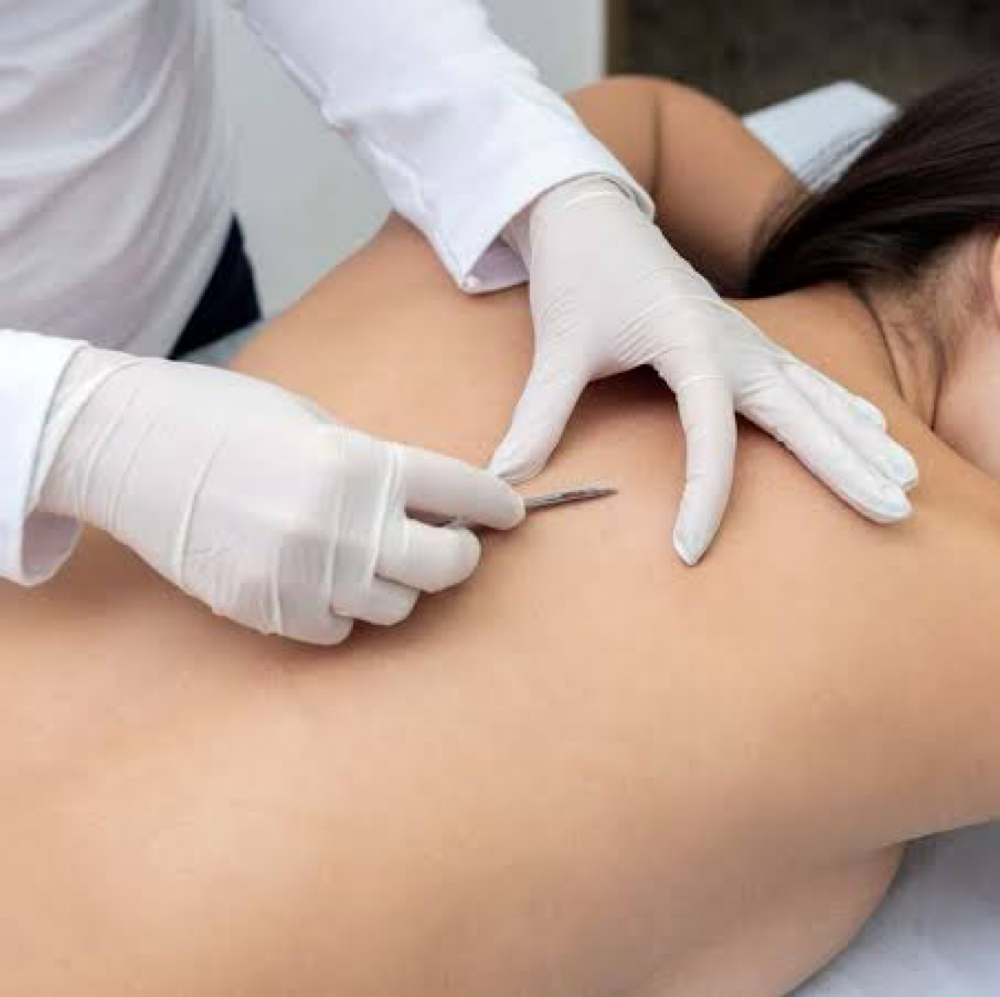 ✨ Pore Refining Extraction Add-On at Chatuge Med Spa & Fitness in Hiawassee, GA