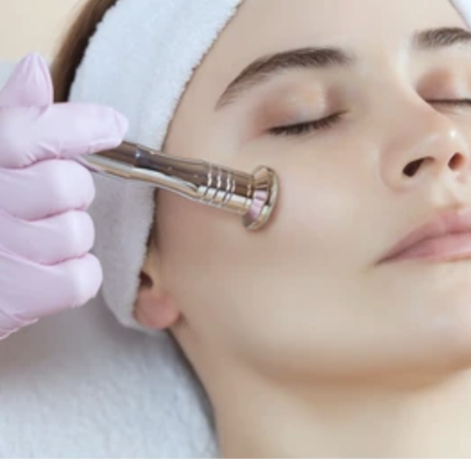 Microdermabrasion add on