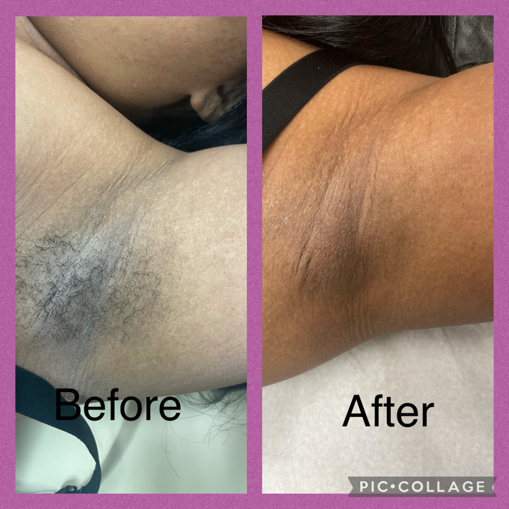 Underarm Waxing