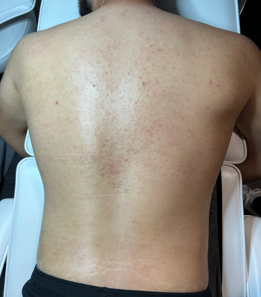 Full Back Wax (Men)